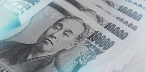 Why is the yen so underestimated? USD/JPY forecast teaser image